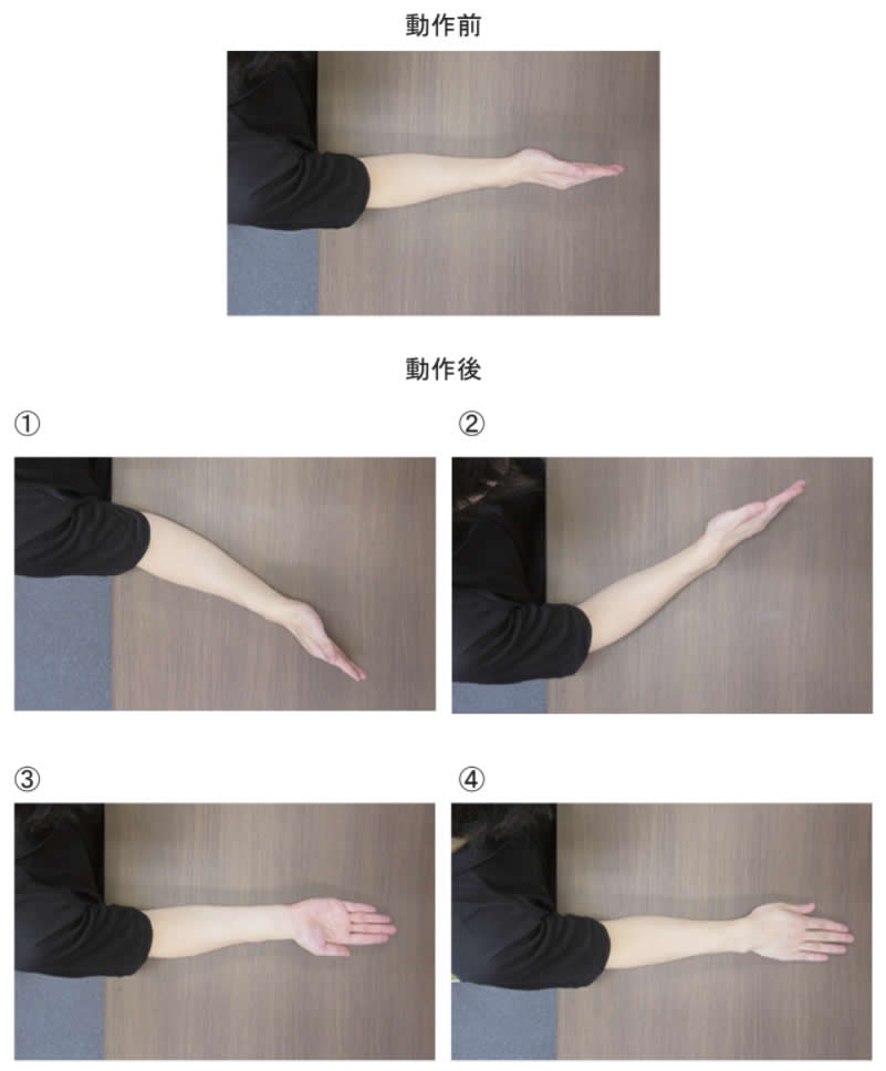 前腕の動きを肩部上方から撮影した写真を別に示す。 前腕の回外を示すのはどれか。