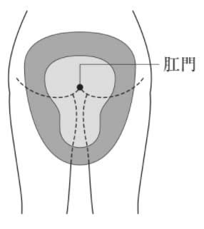 選択肢1