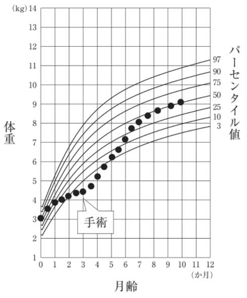 Aちゃん（生後10か月、男児）は、先天性心疾患（congenital heart disease）のため手術を受けた。Aちゃんの体重の変化を図に示す。 手術後から現在までの体重の変化に対する評価で適切なのはどれか。