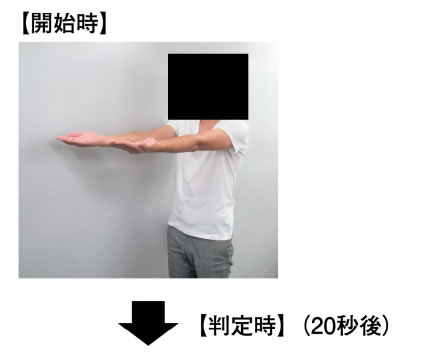 Barré〈バレー〉徴候の査定の開始時と判定時の写真を別に示す。左上肢のBarré〈バレー〉徴候陽性を示すのはどれか。