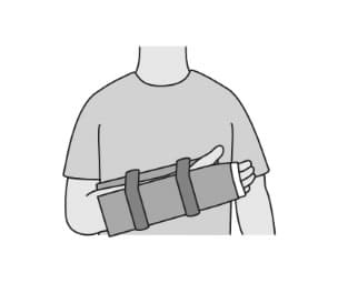 選択肢1