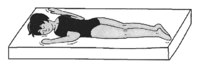 選択肢1