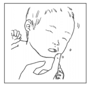 選択肢1