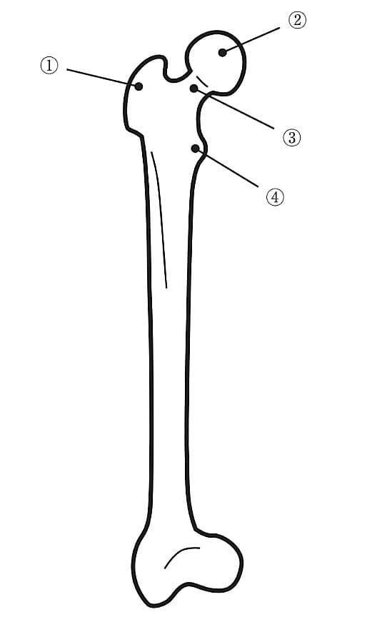 右大腿骨前面を図に示す。 大腿骨頸部はどれか。