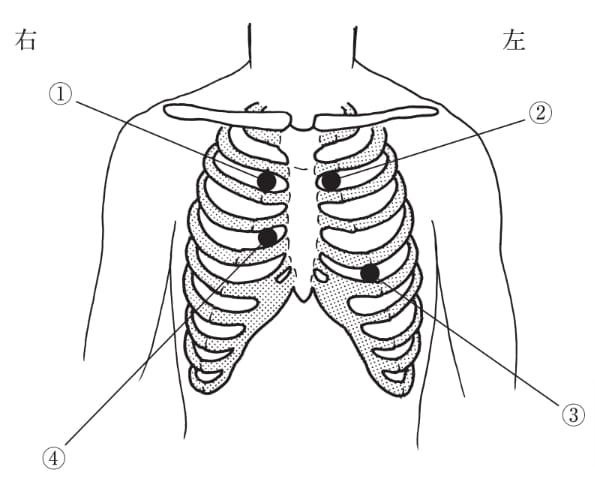 成人の心音の聴取部位を図に示す。 心音の聴診における、僧帽弁領域はどれか。ただし、聴取部位は●で示す。