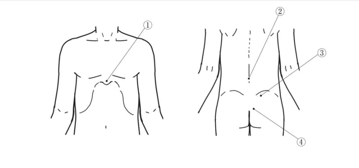 成人の骨髄検査の穿刺部位を図に示す。 正しいのはどれか。